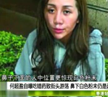 称自己不导致将减肥药和退烧药一起头晕,视频反应等等呕吐,小心服用微整瘦药物小腿图片